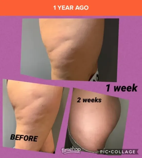 Body Boost Before & After