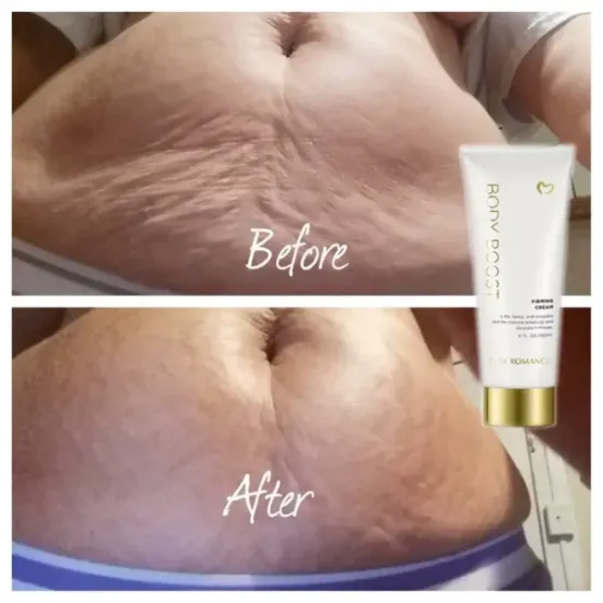 Body Boost Before & After v3